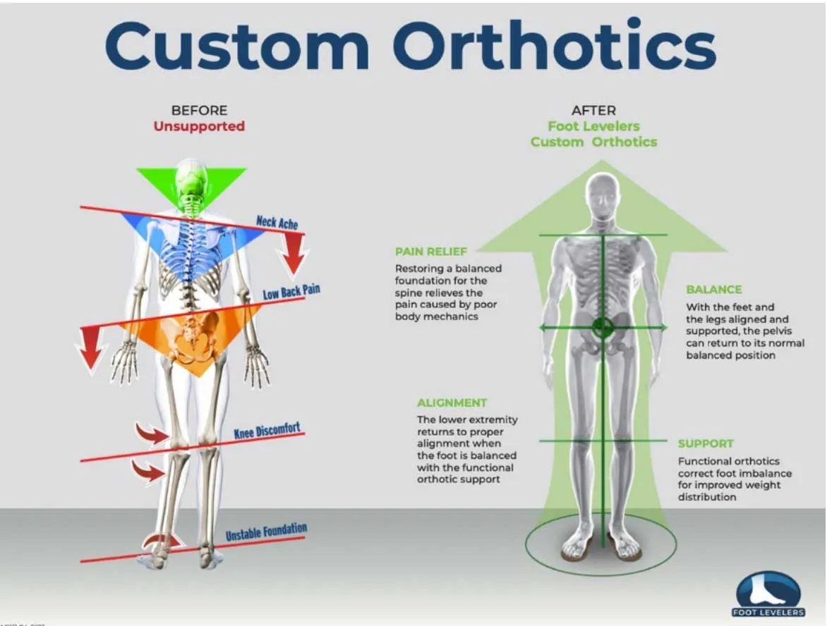 Chiropractic Worthington OH Custom Orthotics Graphic Foot Levelers Graphic Showing The Effect Of Custom Orthotics